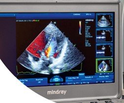 Ria Snoek_echografie