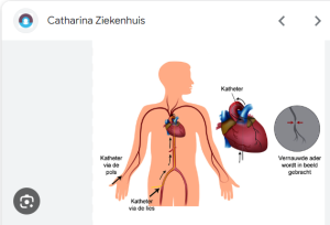 Hartkatheterisatie